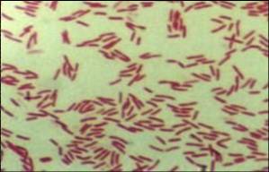 レジオネラ菌写真